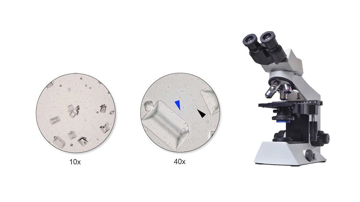 Estudio del sedimento urinario mediante microscopio