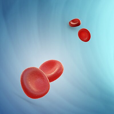 Anemia: Parámetros eritrocitarios de nueva generación