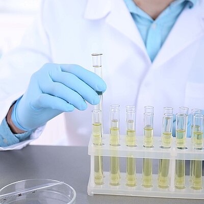 Guías Europeas de Uroanálisis 2023: Bloque 3 - Recogida y conservación de la muestra