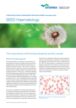 Sysmex SEED_The importance of thrombocytopenia and its causes