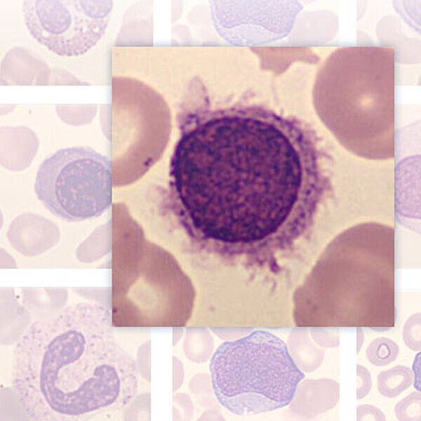 Sysmex Cellspotting Quiz