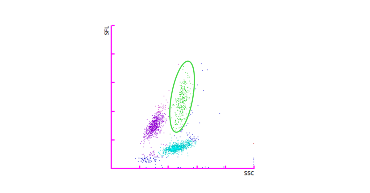 Fig. 3 Diagrama de dispersión WDF que muestra un ligero aumento en los niveles de monocitos (círculo verde).