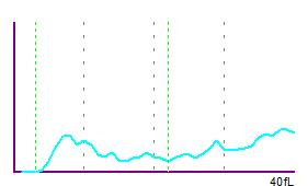 Fig. 2 Histograma de PLT que muestra una distribución anómala.
